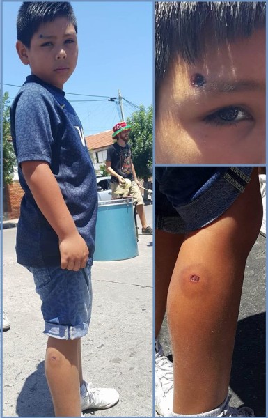 Carlos Ariel Sulca, 8 años. Foto: gentileza La Garganta Poderosa