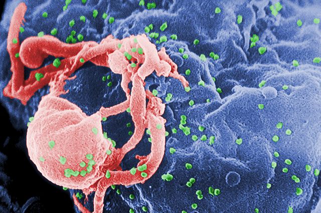 Microfotografía con MEB de VIH-1 en liberación (en verde) en un cultivo de linfocitos. Esta imagen ha sido coloreada para resaltar las características importantes; para la imagen original en blanco y negro véase PHIL 1197. Las múltiples protuberancias redondeadas sobre la superficie celular representa los sitios de ensamblado y gemación de viriones.