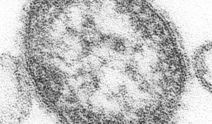 La vaccinazione contro il morbillo dovrebbe essere obbligatoria?