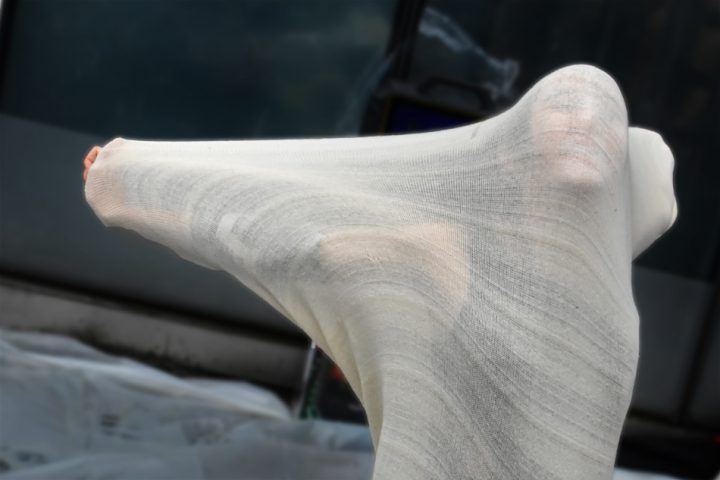 L’art et les droits des femmes