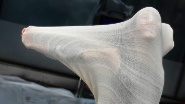 L’art et les droits des femmes