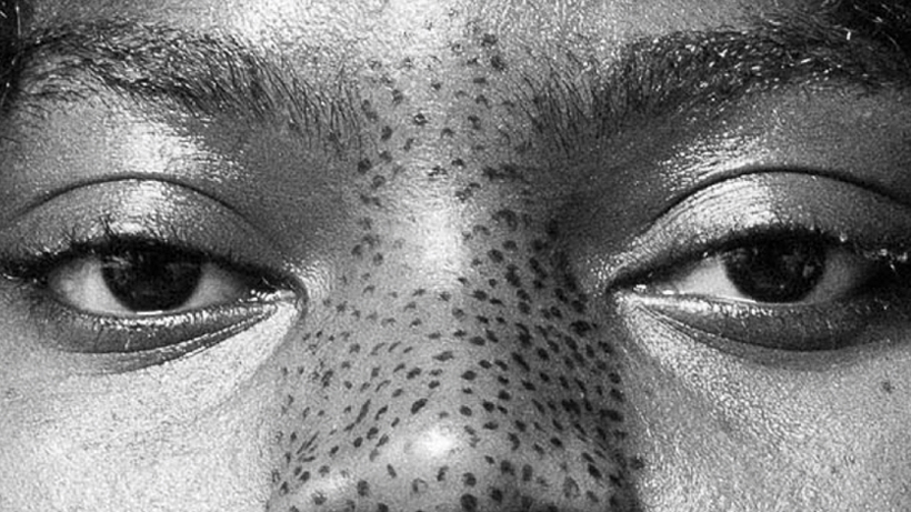 „Black in Berlin” Ausstellung: Kampf gegen den Alltagsrassismus